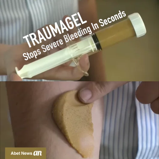 Traumagel-featured-image